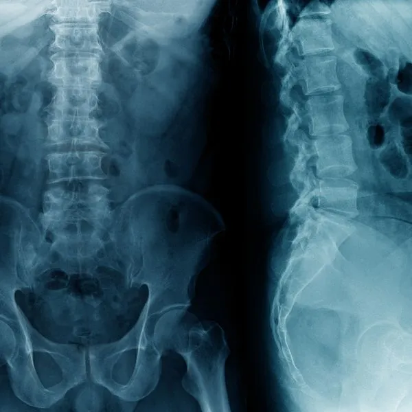 1-spine-2